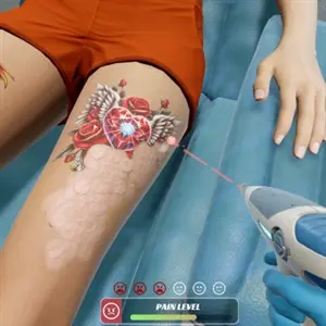 Tattoo Removal Simulator - Schmerzintensität